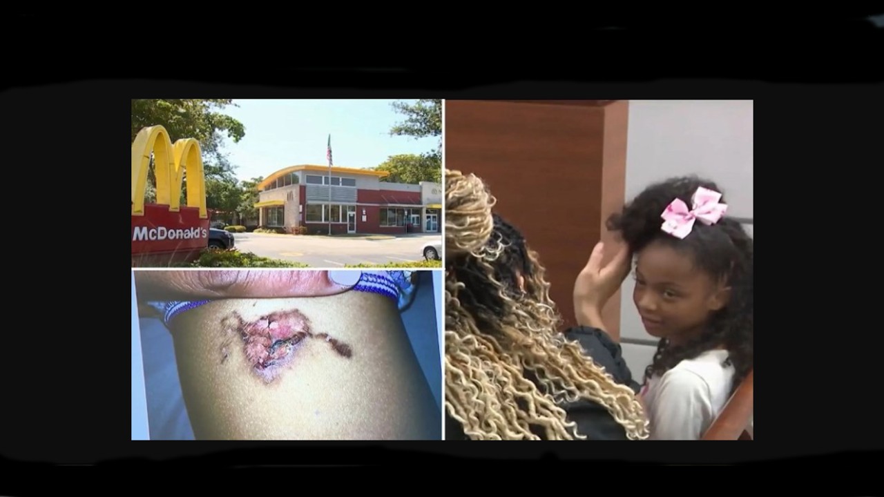 $800,000 Payout Just Awarded To 8-Year-Old For Second Degree Burn From Chicken McNugget